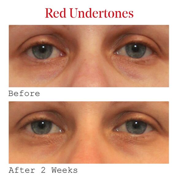 Murad - Vita-C Eyes - Dark Circle Corrector - Brand New! - Picture 4 of 5